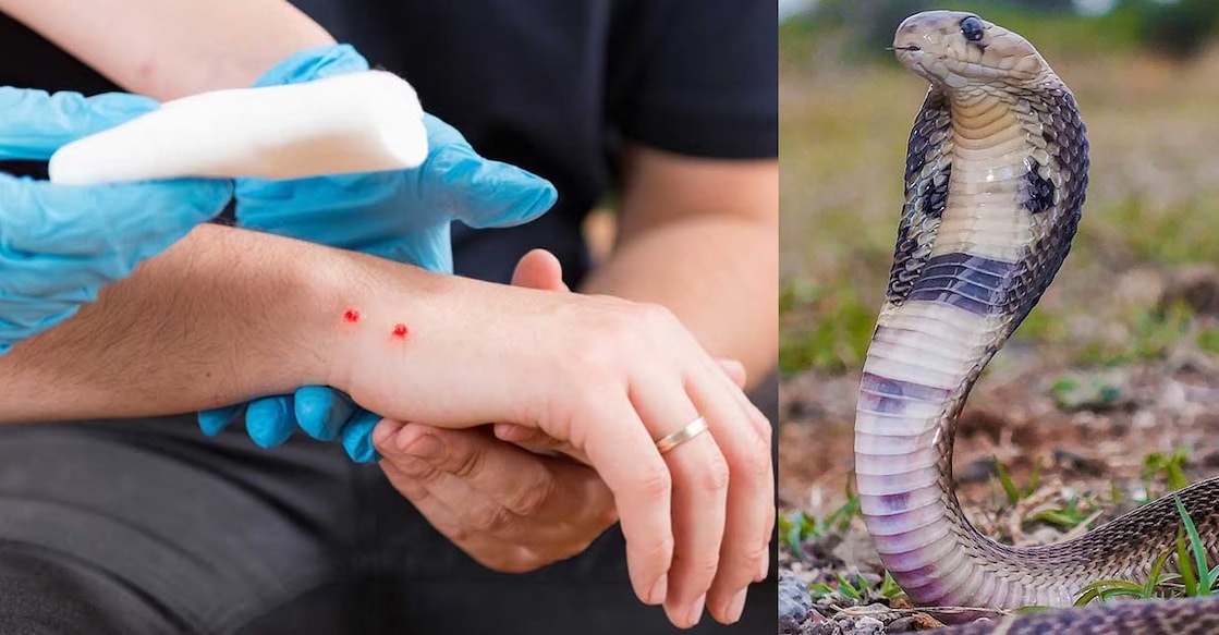media-snake-bite-treatment